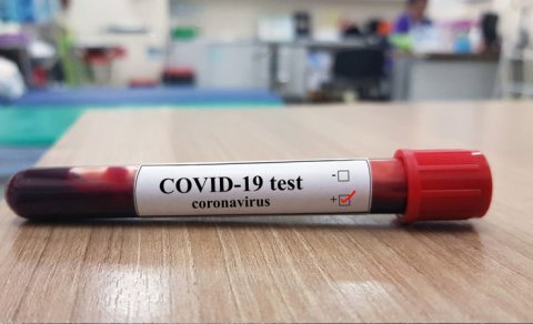 Koronavirus yoluxanların sayı azaldı - 23 nəfər öldü