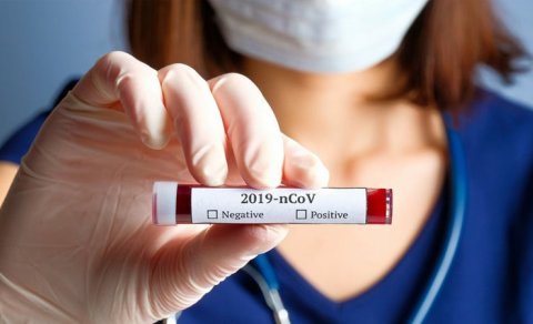 Azərbaycanda 29 yaşlı xanım məmur koronavirusdan öldü