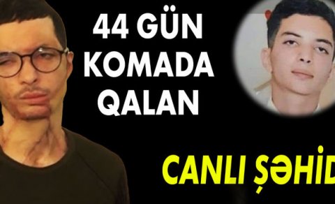 Müharibədə yanında minamyot mərmisi partladı, tanınmaz hala düşdü - VİDEO