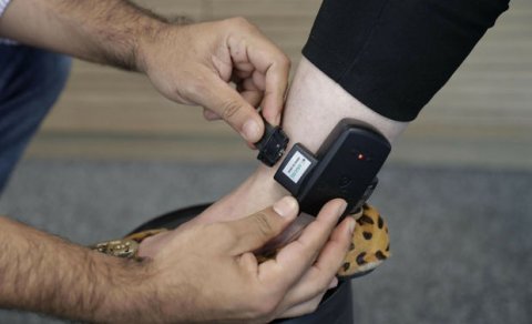 Azərbaycanda ginekoloqa elektron qolbaq taxıldı