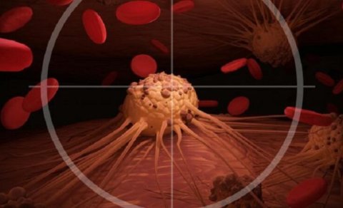 Alimlər bədəndə gizli inkişaf edən xərçəngin əlamətlərini AÇIQLADI