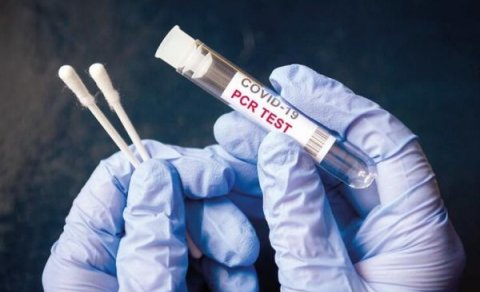 Azərbaycanda 20 mindən çox koronavirus testi istehsal olunub