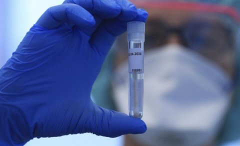 Son sutkada koronavirusa yoluxanların sayı AÇIQLANDI