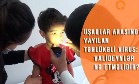 Uşaqlar arasında yayılan təhlükəli virus: valideynlər nə etməlidir? - VİDEO