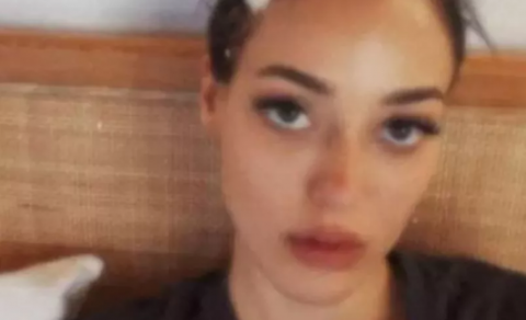 Məşhur aktrisanın serial çəkilişi zamanı başı yarıldı (FOTO)