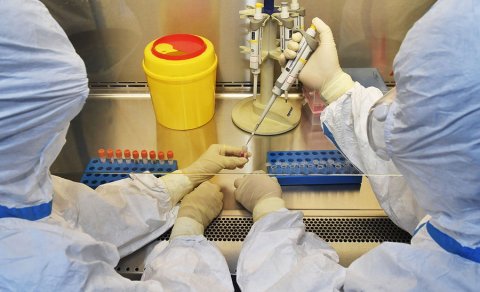75 faizə qədər ölüm nisbətinə malik olan Nipah virusunun əsas komponenti aşkar edildi