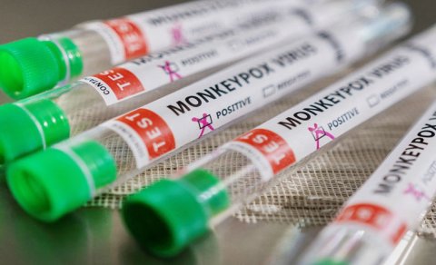
Meymunçiçəyi virusuna qarşı antibiotiklərdən istifadə oluna bilər? - RƏSMİ