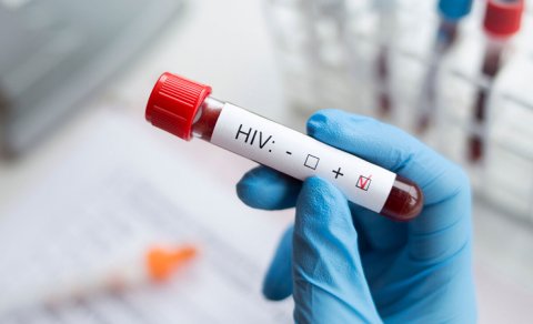 Yeni xərçəng dərmanı HIV-i tamamilə sağalda bilər - Alimlər