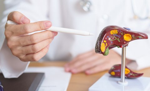 Qaraciyər fibrozunun qeyri-aşkar simptomları açıqlandı