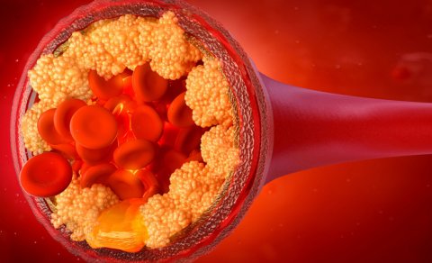 Dietoloq xolesterolu aşağı salan qidaları açıqladı
