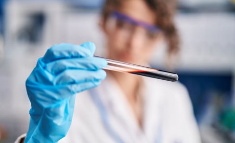 Mədəaltı vəzi xərçəngini erkən mərhələdə dəqiq aşkarlayan test yaradıldı