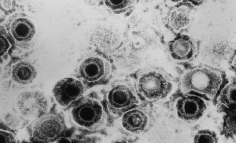 Alimlər izah olunmayan herpes epidemiyasının səbəbini açıqladı