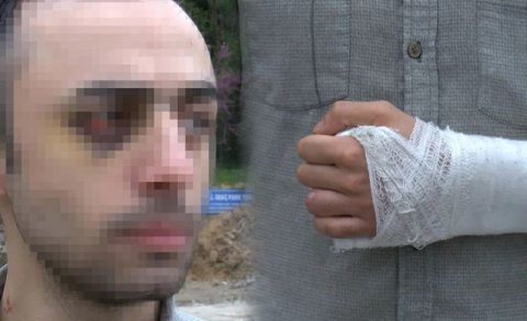 Türkiyədə azərbaycanlı tələbəni döyüb videoya çəkənlərə ağır cəza - FOTO