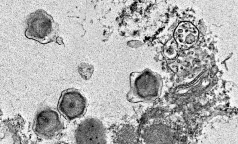 Okeanda tapılan 230 yeni nəhəng virus insan sağlamlığına təsir edə bilər - TƏDQİQAT
