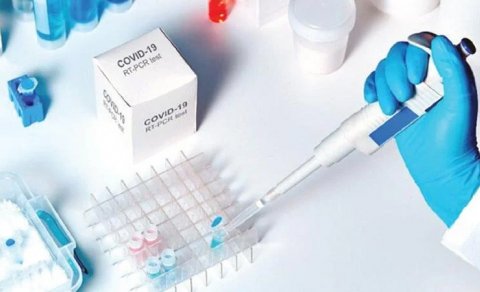 İnnovasiya və Təchizat Mərkəzi 11 milyonluq test alır