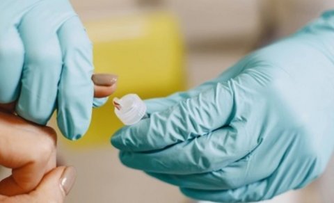 İnnovasiya və Təchizat Mərkəzi 21 milyon manatlıq test alır