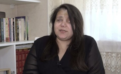 Gəncə terrorunda gözlərini itirən qadın başına gələnləri danışdı: "Qoymayın ölüm, qızlarım var"
