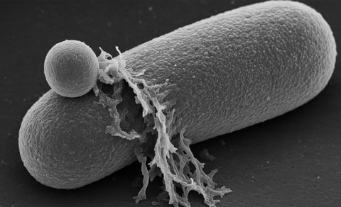 Antibiotiklərin bakteriyaları öldürməsi real vaxt rejimində görüntüləndi