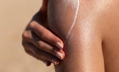 Günəş yanığından qorunmaq dəri xərçənginin qarşısını ala bilər