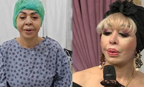 Ruhəngiz Allahverdiyeva plastik əməliyyatdan sonra - FOTO