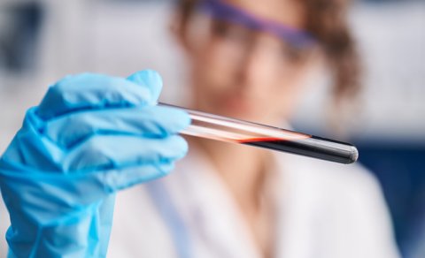 Qan hüceyrələrini "cavanlaşdırmaq" üçün dərman hazırlandı