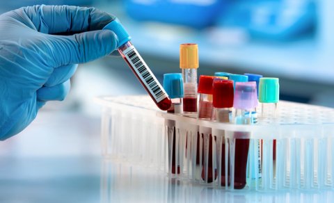 Beş qan göstəricisi erkən ölüm riskini artıra bilər