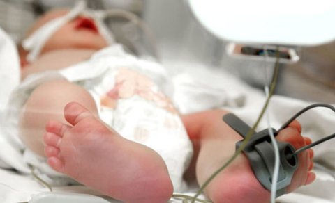 Yenidoğulan uşaqların ölümünün səbəbi nədir?