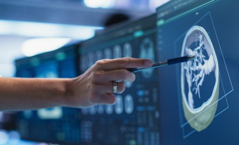 Kimyaterapiyanın təsirini artırmağın gözlənilməz yolu tapıldı