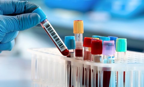 Ağ ciyər xərçəngini tək bir hüceyrə ilə aşkar etmək mümkün oldu