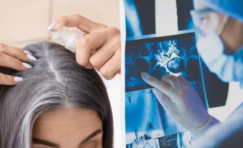 Ağ saçlara görə narahat olmayın: Saçın qocalmasının gözlənilməz funksiyası...