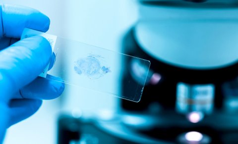 Qastroenteroloq: Üç pəhriz nümunəsi xərçəng riskini azaldır