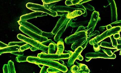 Niyə immunitet vərəm ilə mübarizə apara bilmir? - Alimlər açıqladı