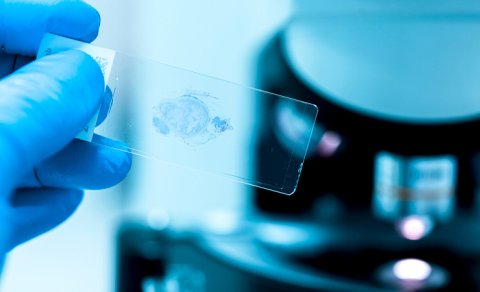 Hüceyrələrin qocalmasının yeni mümkün səbəbi tapıldı