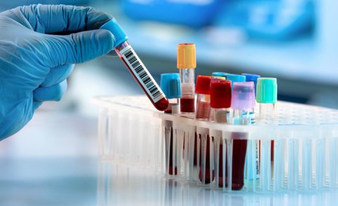 Həkim hər il edilməli olan testləri açıqladı