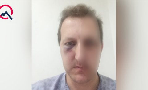 Bakıda Xalq artistinin oğlunu döydülər - Saxlanılan var