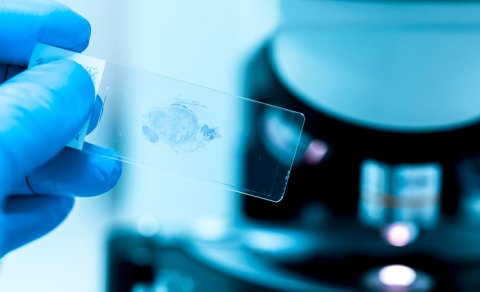 Erkən yaşlanmanın yeni səbəbi aşkarlandı