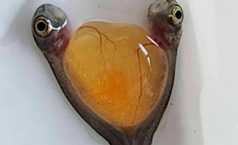 İki baş və bir bədən: Alimlər təsadüfən nadir siam əkizlərini aşkar etdi