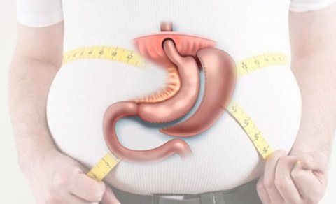 Kimlər mədə kiçiltmə əməliyyatını etdirə bilər?