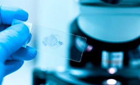 B2 vitamini xərçəng hüceyrələrinin ölümünə qarşı qoruyucu ola bilər - Alimlər