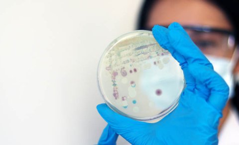 Bağırsaq bakteriyaları beynin zədələnməsi ilə əlaqəli ola bilər