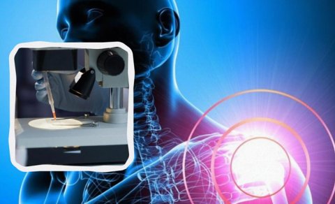 Alman alimlərinin kəşfi osteoporozun inkişafını dayandıra bilər