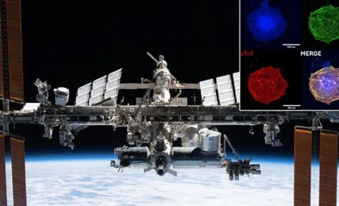 Ürək köçürülməsində yeni ümid: Dünyada olmayan imkan kosmosda tapıldı