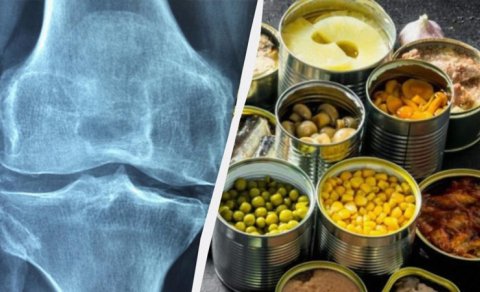 Həkim 50 yaşdan sonra sümükləri möhkəm saxlamağa kömək edən ən yaxşı qidanı açıqladı