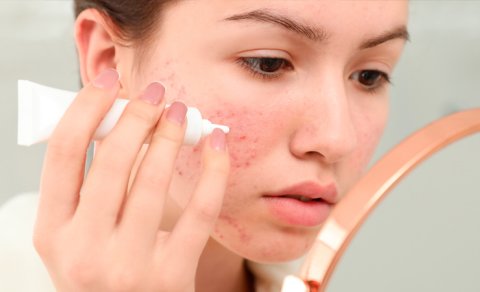 Dermatoloq sağlam dəri üçün lazım olan məhsulları açıqladı