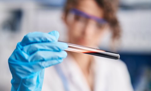 Hantavirus COVID-19 qədər təhlükəlidir? - Alimdən açıqlama