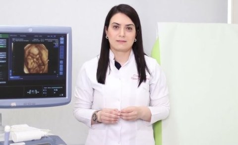 Ginekoloq-həkim Günel Nəcəfovanın otağında oğurluq