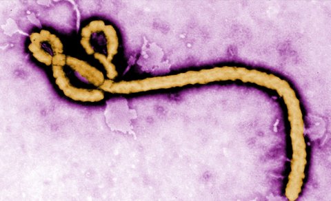 Ebola virusu təhlükəsi böyüyür