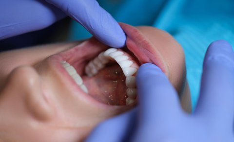 Stomatoloq "Ozempic"in diş sağlamlığına mümkün mənfi təsirlərindən danışdı