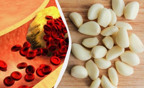 Daha çox sarımsaq yesəniz, xolesterinlə nə baş verə bilər?