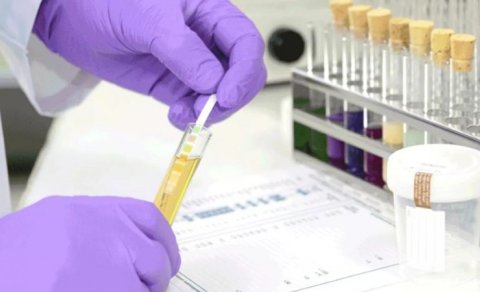 Nikahdan əvvəl cütlüklər narkoloji testdən keçməlidir?
